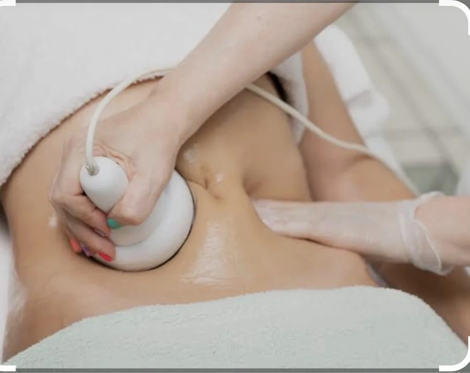 Tratamientos reductores abdomen (10 sesiones)