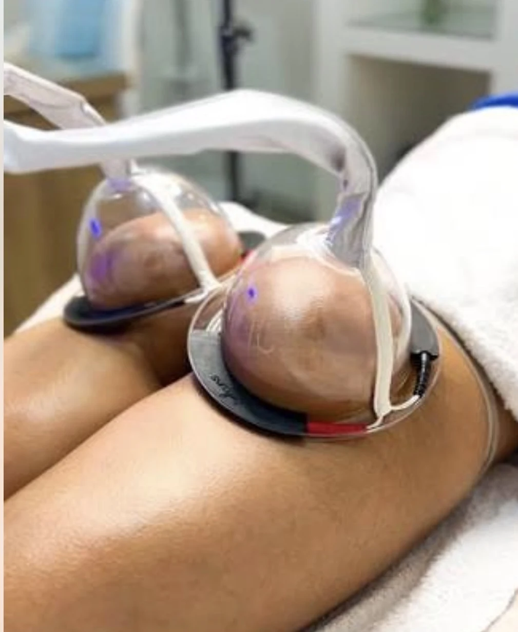 Electrovacum (10 sesiones)
